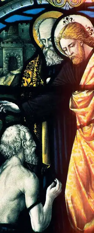 Teresa Neumann: estigmas en el corazón y en las manos (Medical photograh, 1926)